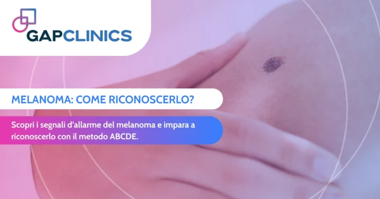 Melanoma come riconoscerlo e affrontarlo sin dalle fasi iniziali