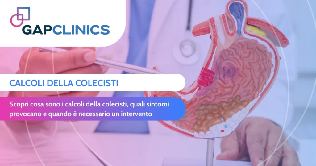 Calcoli della colecisti - sintomi, cause e quando intervenire