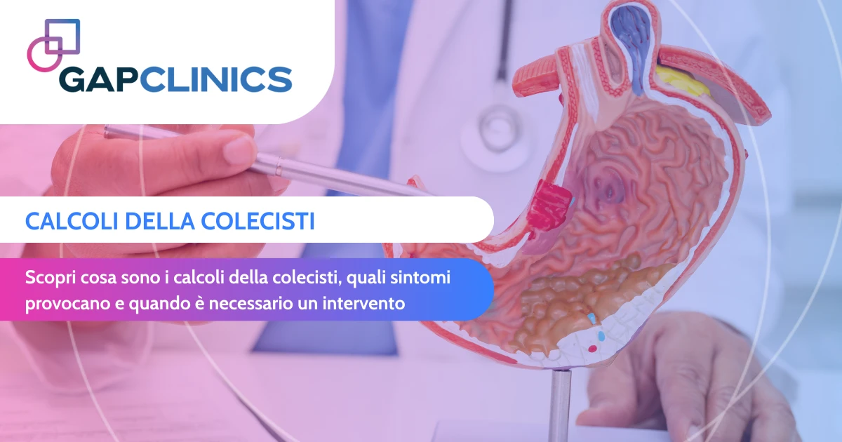 Calcoli della colecisti - sintomi, cause e quando intervenire